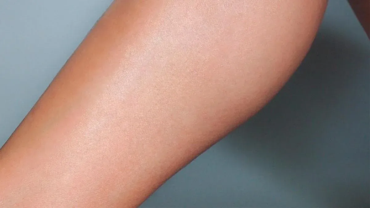 Laser hair removal, after treatment at Symphony Clinic