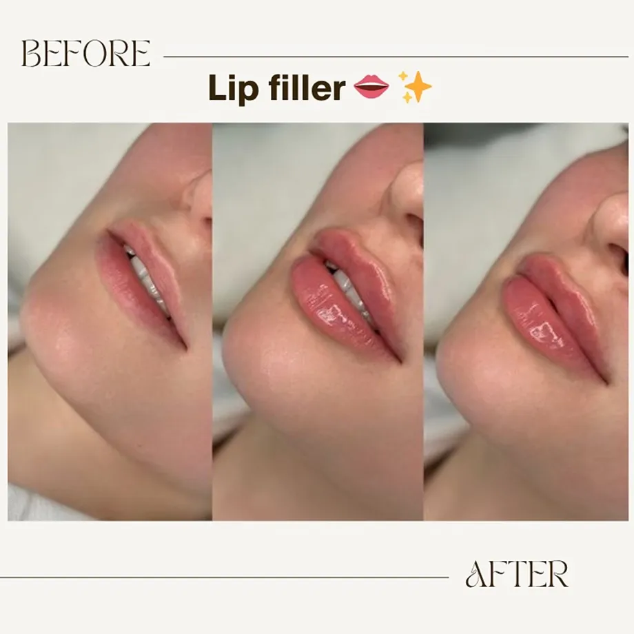 Latest treatment shared on the Symphony Clinic Instagram account