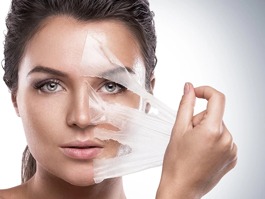 Chemical Peeling Benefits