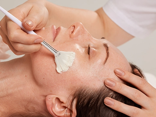 How Chemical Peel Works