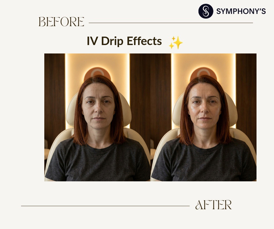 Glutathione IV drip before and after at Symphony Clinic Dubai: radiance restored