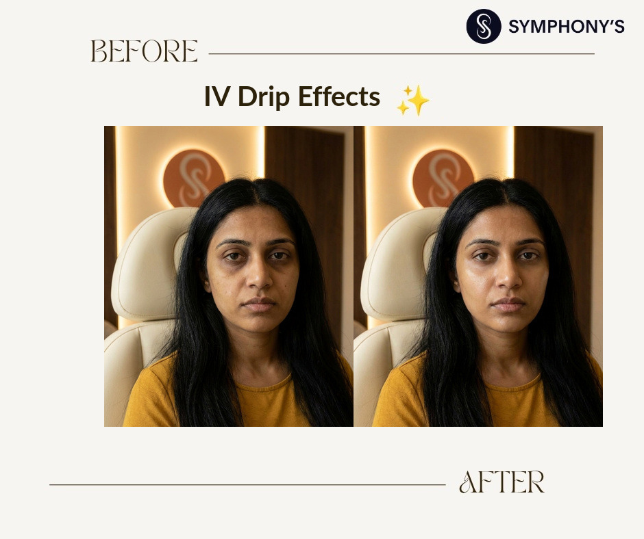 Glutathione IV drip before and after at Symphony Clinic Dubai: rested look
