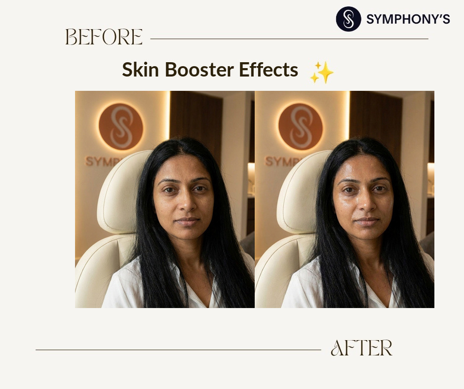 Skin booster before and after: skin hydrated and plumped
