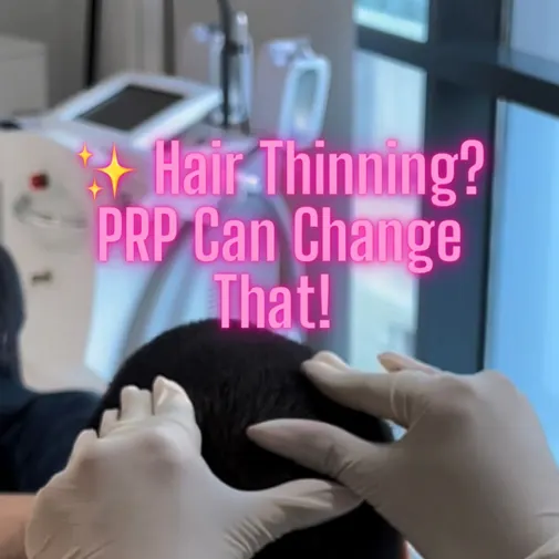 Symphony Clinic Dubai Instagram reel - PRP