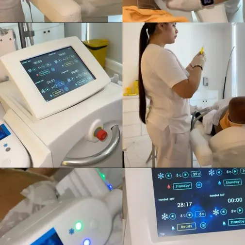 Symphony Clinic Dubai Instagram reel - CoolSculpting
