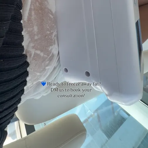 Symphony Clinic Dubai Instagram reel - CoolSculpting
