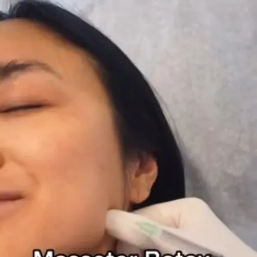 Symphony Clinic Dubai Instagram reel - Botox