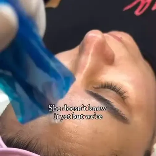 Symphony Clinic Dubai Instagram reel - Microneedling