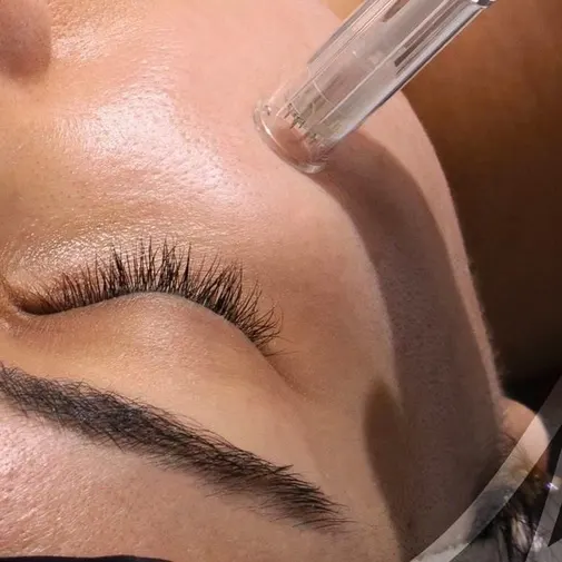 Symphony Clinic Dubai Instagram reel - Mesotherapy