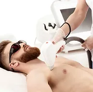 Face laser hair removal treatment