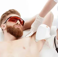 Chest laser hair removal for men
