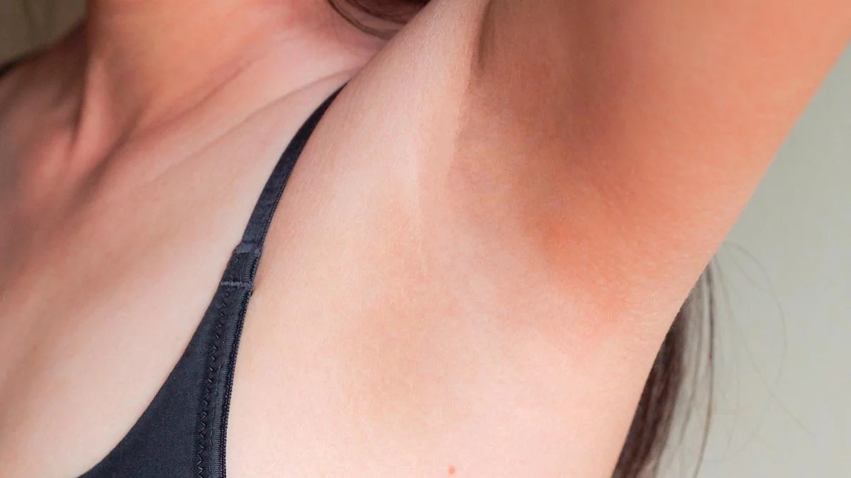 After full body laser hair removal results