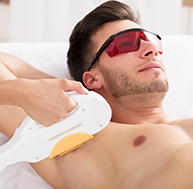 Upper body laser hair removal package